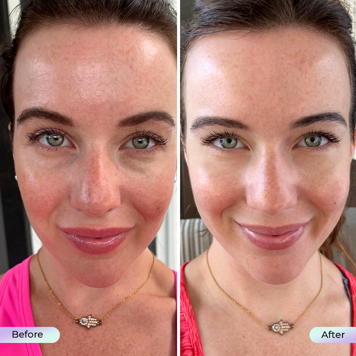 Summersale: Aduro Facial Mask + Free Aduro Palm V1