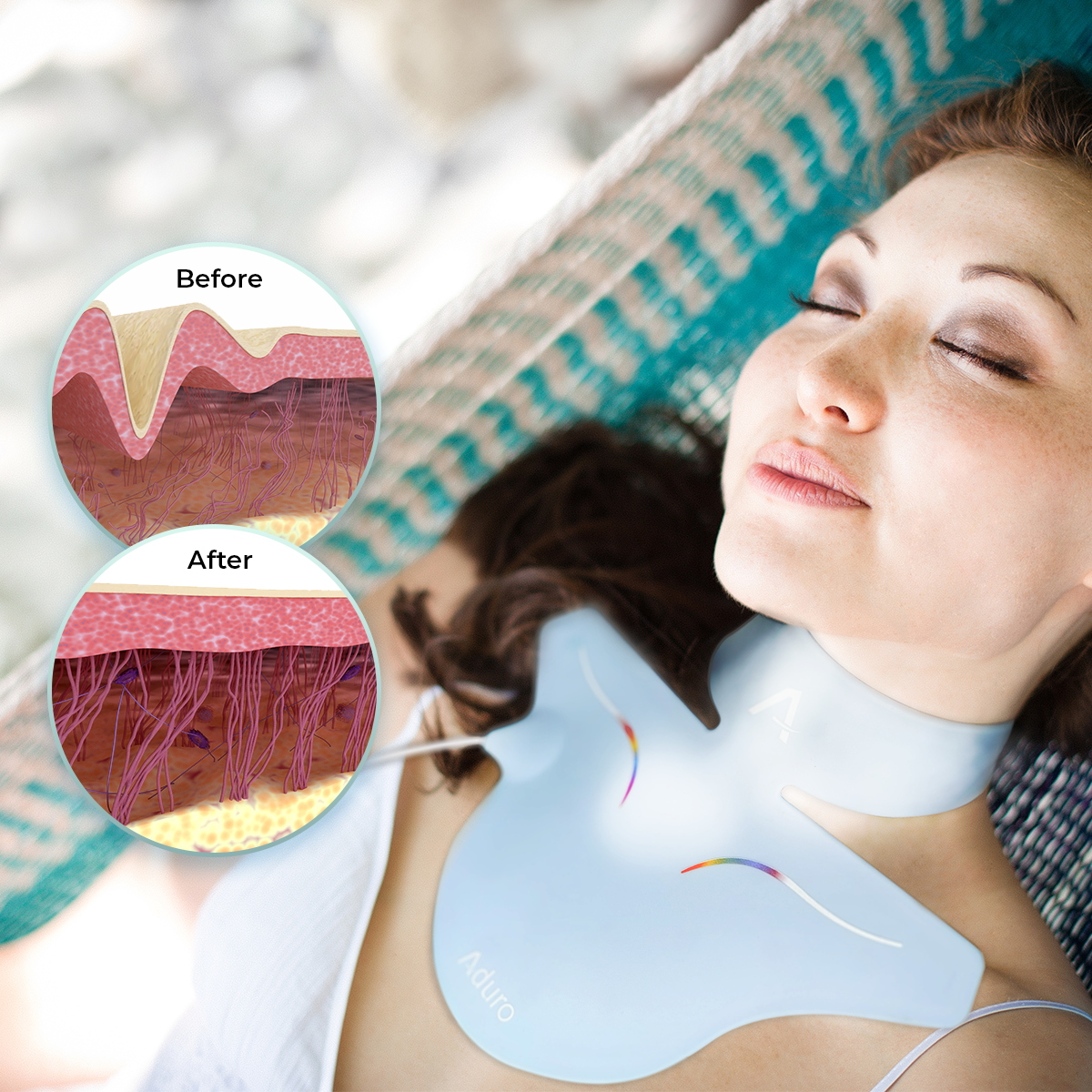 Summersale: Aduro Neck and Décolleté Mask + Free Aduro Palm V1