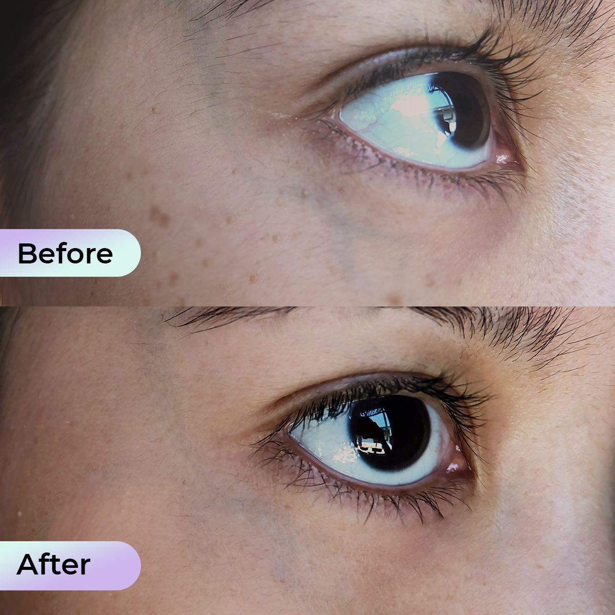 Aduro Eye Mask