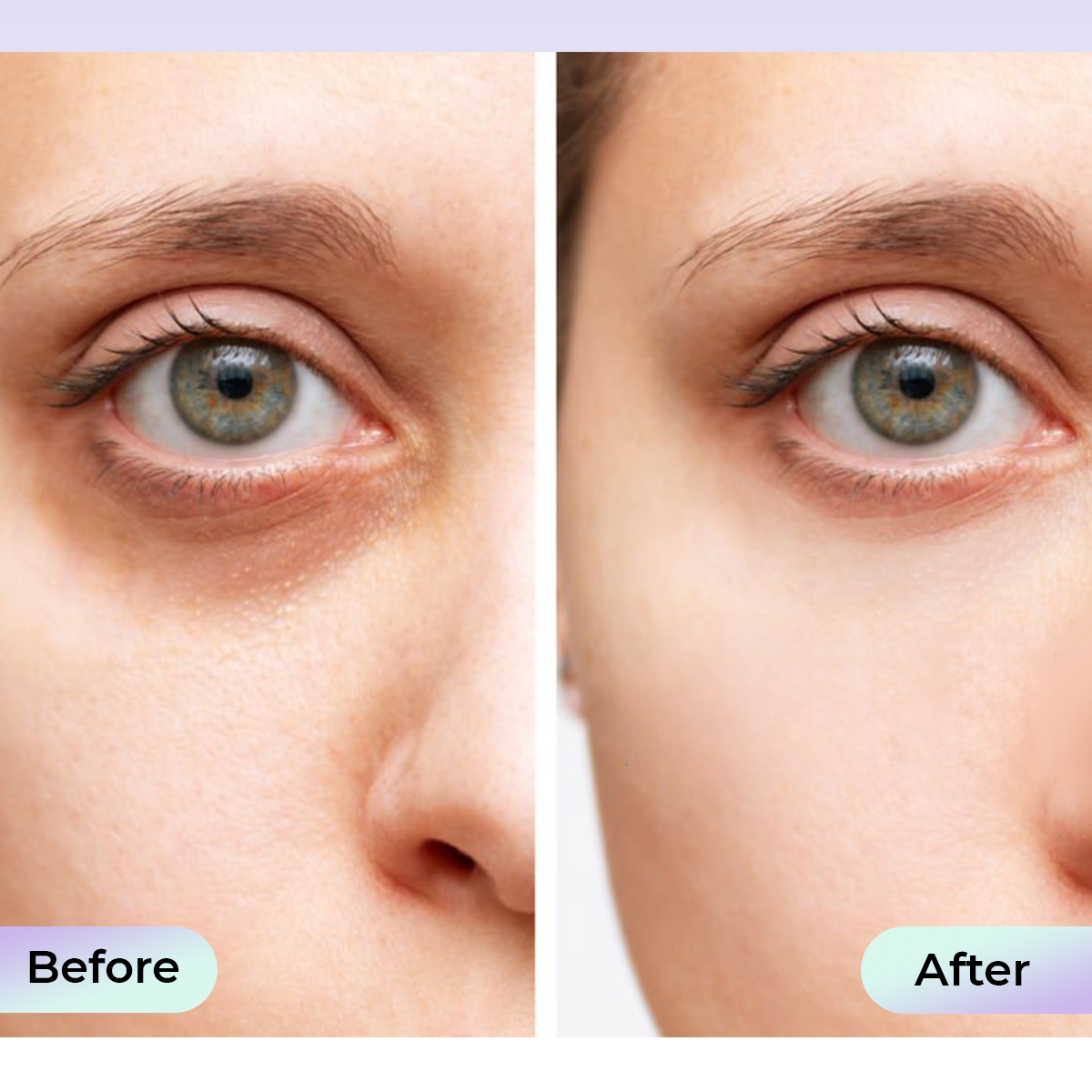 Aduro Eye Mask