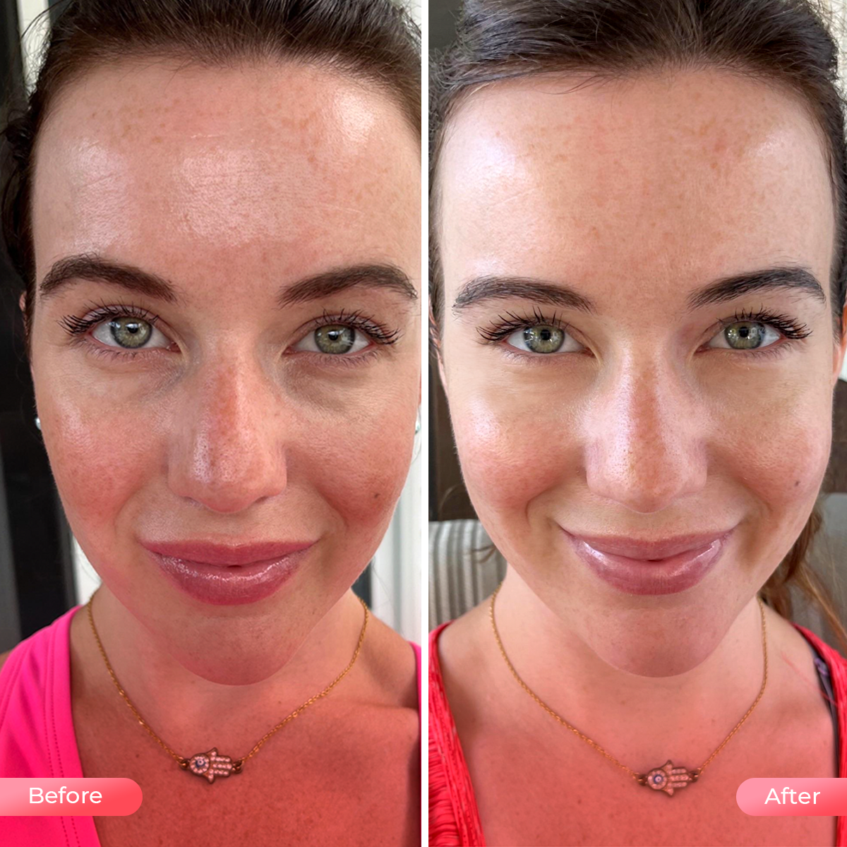 Aduro Facial Mask Before and after looking amazing